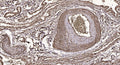 Anti-TNP1 antibody (4-54 aa) (STJ196225) – Figure 1 of 1
