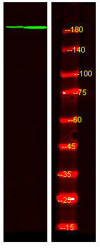 Anti-Phospho-TP53BP1-Ser1778 antibody (STJ196234) – Figure 1 of 1