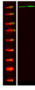 Anti-Phospho-ALK-Tyr1078 antibody (STJ196236) – Figure 1 of 1