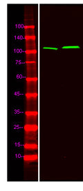 Anti-Phospho-CTNND1-Tyr904 antibody (STJ196266) – Figure 1 of 1