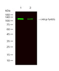 Anti-Phospho-KIT-Tyr823 antibody (STJ196276) – Figure 1 of 1
