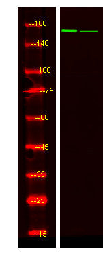 Anti-Phospho-IGF1R-Tyr980 antibody (STJ196328) – Figure 1 of 1
