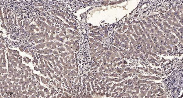 Anti-Phospho-ITPR1-Ser1756 antibody (STJ196331) – Figure 1 of 1