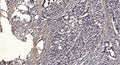 Anti-Phospho-IRF7-Ser471/472 antibody (STJ196332) – Figure 1 of 1