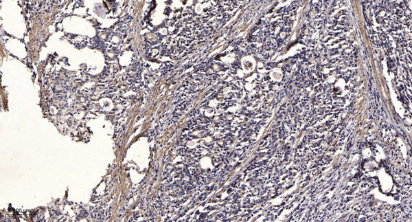 Anti-Phospho-IRF7-Ser471/472 antibody (STJ196332) – Figure 1 of 1
