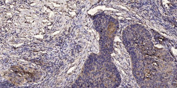 Anti-Phospho-JAK3-Tyr980/981 antibody (STJ196341) – Figure 1 of 1