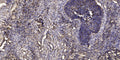 Anti-Phospho-LCP1-Tyr28 antibody (STJ196347) – Figure 1 of 1
