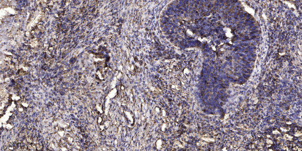 Anti-Phospho-LCP1-Tyr28 antibody (STJ196347) – Figure 1 of 1