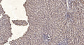 Anti-Phospho-CSF1R-Tyr923 antibody (STJ196356) – Figure 1 of 1