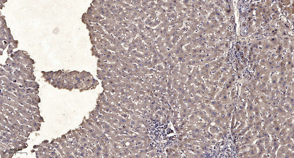 Anti-Phospho-CSF1R-Tyr923 antibody (STJ196356) – Figure 1 of 1