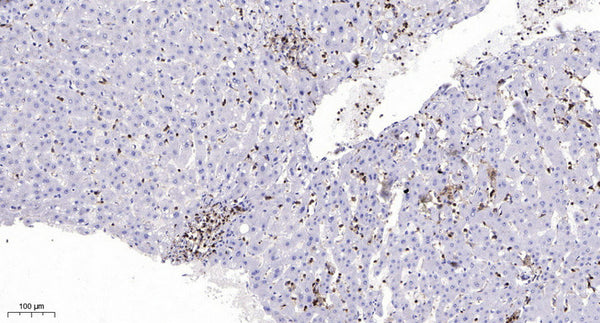 Anti-Phospho-MRE11-Ser676 antibody (STJ196358) – Figure 1 of 1