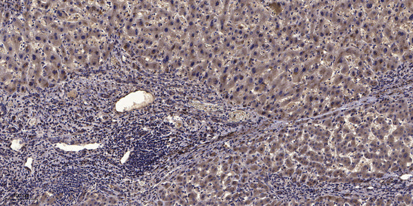 Anti-Phospho-MYH9-Ser1943 antibody (STJ196359) – Figure 1 of 1