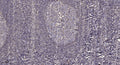Anti-Phospho-PNKP-Ser114/Thr118 antibody (STJ196388) – Figure 1 of 1