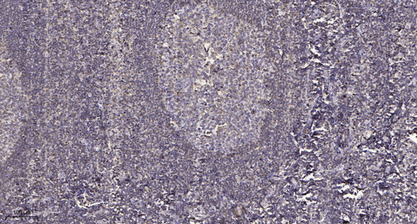 Anti-Phospho-PNKP-Ser114/Thr118 antibody (STJ196388) – Figure 1 of 1
