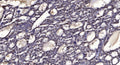 Anti-Phospho-RPTOR-Ser792 antibody (STJ196397) – Figure 1 of 1
