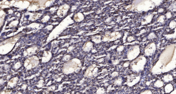 Anti-Phospho-RPTOR-Ser792 antibody (STJ196397) – Figure 1 of 1