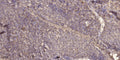 Anti-Phospho-RICTOR-Thr1135 antibody (STJ196401) – Figure 1 of 1