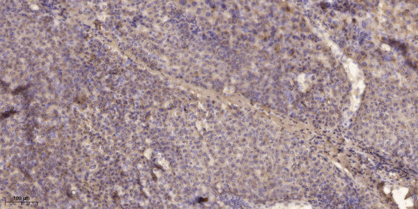 Anti-Phospho-RICTOR-Thr1135 antibody (STJ196401) – Figure 1 of 1