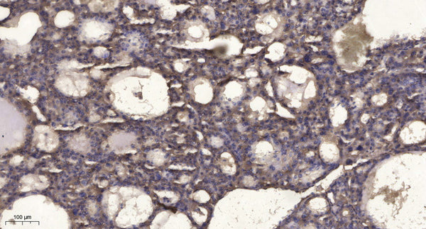 Anti-Phospho-RIPK3-Ser227 antibody (STJ196403) – Figure 1 of 1