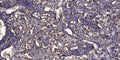 Anti-Phospho-SIRT1-Ser27 antibody (STJ196424) – Figure 1 of 1