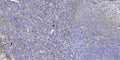 Anti-WT1-AS antibody (20-100 aa) (STJ196505) – Figure 1 of 1
