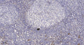 Anti-PDE6G antibody (10-90 aa) (STJ196524) – Figure 1 of 1