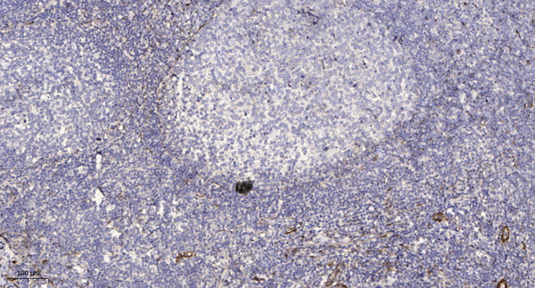 Anti-PDE6G antibody (10-90 aa) (STJ196524) – Figure 1 of 1