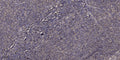 Anti-DEFB1 antibody (1-50 aa) (STJ196527) – Figure 1 of 1