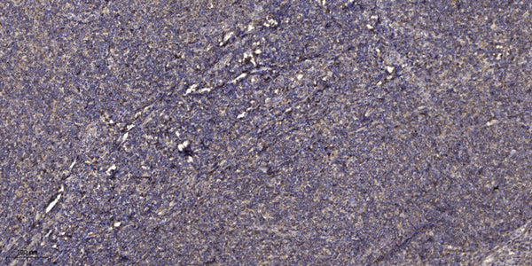 Anti-DEFB1 antibody (1-50 aa) (STJ196527) – Figure 1 of 1