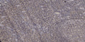 Anti-THBS1 antibody (STJ196535) – Figure 1 of 1
