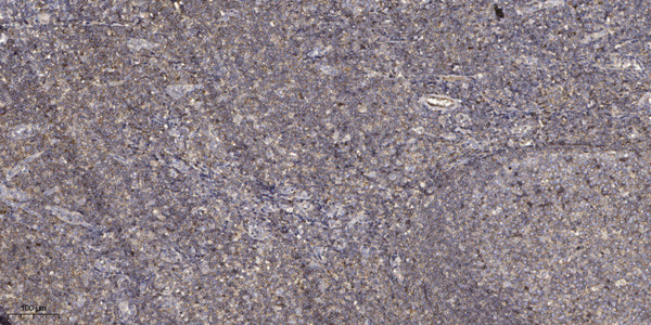 Anti-THBS1 antibody (STJ196535) – Figure 1 of 1