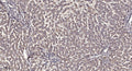 Anti-VAMP8 antibody (46-96 aa) (STJ196538) – Figure 1 of 1