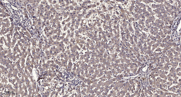 Anti-VAMP8 antibody (46-96 aa) (STJ196538) – Figure 1 of 1