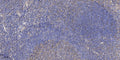 Anti-PSENEN antibody (51-101 aa) (STJ196542) – Figure 1 of 1
