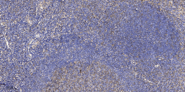 Anti-PSENEN antibody (51-101 aa) (STJ196542) – Figure 1 of 1