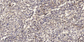 Anti-UQCR10 antibody (9-59 aa) (STJ196544) – Figure 1 of 1