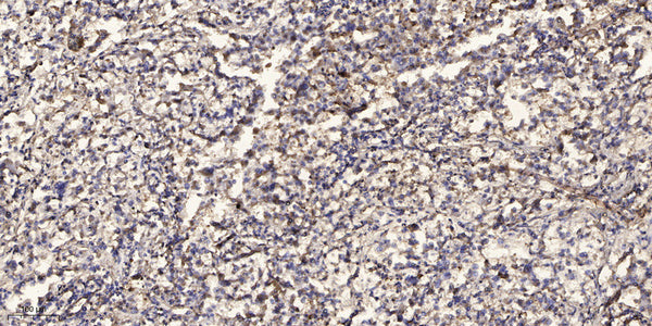 Anti-UQCR10 antibody (9-59 aa) (STJ196544) – Figure 1 of 1