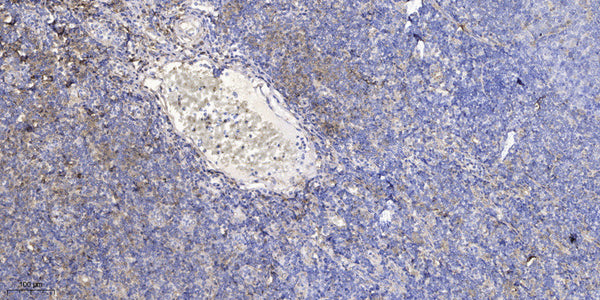 Anti-LINC01546 antibody (7-57 aa) (STJ196546) – Figure 1 of 1