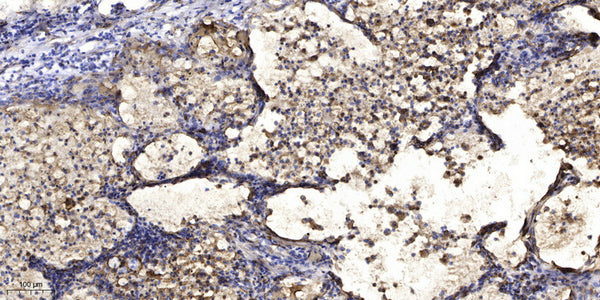 Anti-TMEM167A antibody (17-67 aa) (STJ196552) – Figure 1 of 1