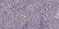 Anti-PMCHL1 antibody (31-81 aa) (STJ196553) – Figure 1 of 1