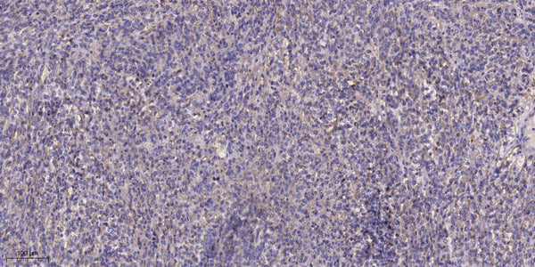 Anti-PMCHL1 antibody (31-81 aa) (STJ196553) – Figure 1 of 1