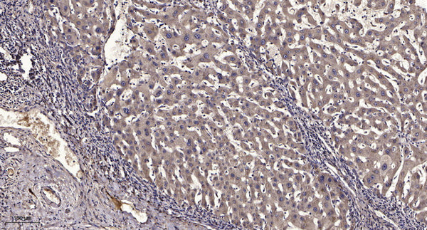 Anti-LAMTOR4 antibody (8-58 aa) (STJ196554) – Figure 1 of 1