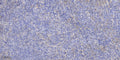 Anti-NC334 antibody (1-24 aa) (STJ196555) – Figure 1 of 1