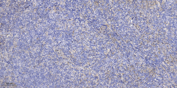 Anti-NC334 antibody (1-24 aa) (STJ196555) – Figure 1 of 1