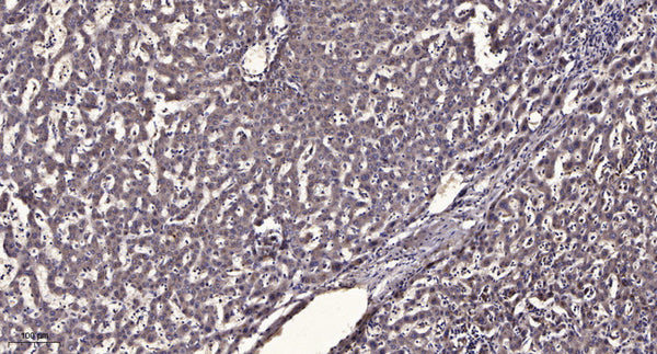 Anti-MZT1 antibody (19-69 aa) (STJ196557) – Figure 1 of 1