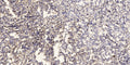 Anti-PYDC1 antibody (25-75 aa) (STJ196561) – Figure 1 of 1
