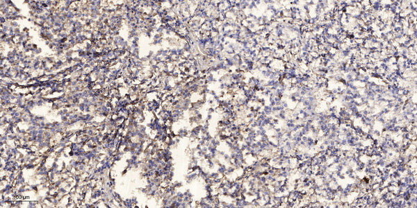 Anti-PYDC1 antibody (25-75 aa) (STJ196561) – Figure 1 of 1