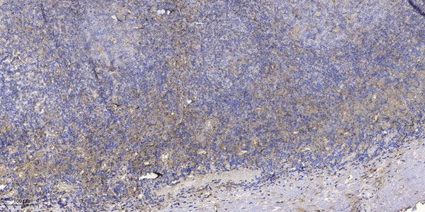 Anti-OCC1 antibody (6-56 aa) (STJ196563) – Figure 1 of 1