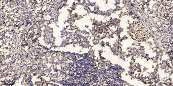 Anti-PET117 antibody (1-51 aa) (STJ196564) – Figure 1 of 1