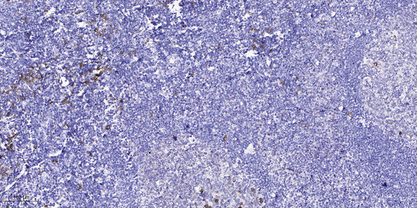 Anti-OTOG antibody (2706-2756 aa) (STJ196568) – Figure 1 of 1